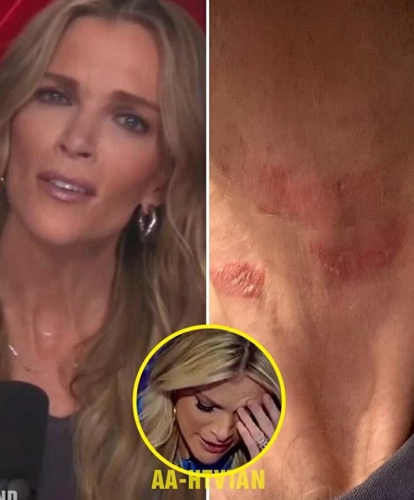 Alarming Reports About Megyn Kelly's Health Leave Fans Desperate for Answers