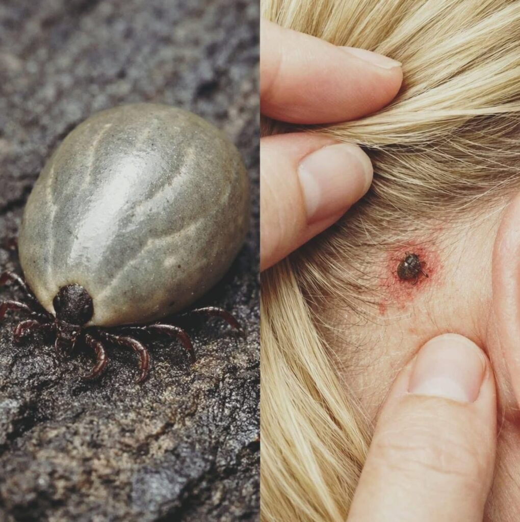 What That Tiny Bug in Your Child's Hair Actually Means