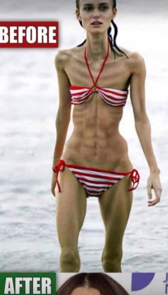 Why Extreme Weight Loss Is Often a Body Crying for Help