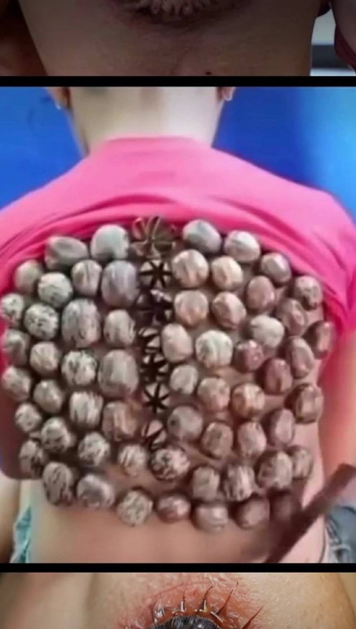 Your Skin Is Sending You Messages and You Keep Ignoring Them